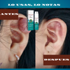 SOUTH MOON-SPRAY PARA CICATRICES